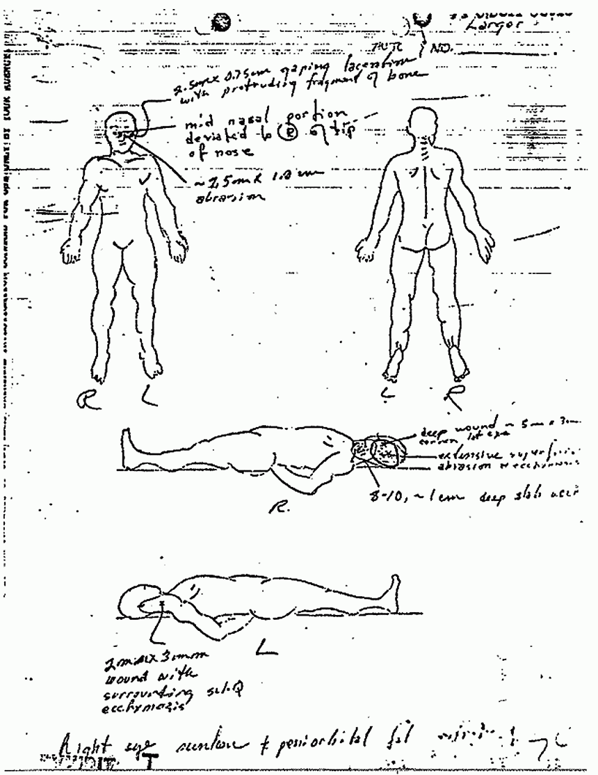 Death certificate and autopsy report of Kimberley MacDonald, p. 7 of 13
