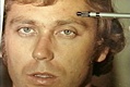 August 14, 1974: FBI photo of alleged wound (scar) of Jeffrey MacDonald