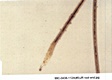 AFDIL Photomicrograph marked; '99C-0438-112A(#5) root end.jpg' depicting hair root