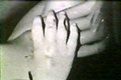 Autopsy photo of right hand of Kristen MacDonald