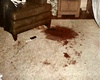 Bloodstains in east bedroom